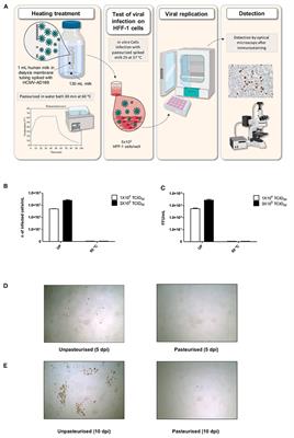 Analysis of Thermal Sensitivity of Human Cytomegalovirus Assayed in the Conventional Conditions of a Human Milk Bank